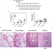 Anti-Angiogenic and Anti-Metastatic Activity of Synthetic Phosphoethanolamine
